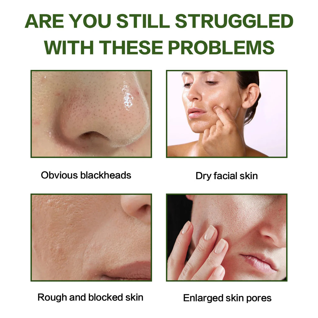 Facial Cleaning Mud Mask